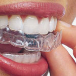 Invisalign, Austin Heights Dental Centre, Coquitlam Dentist